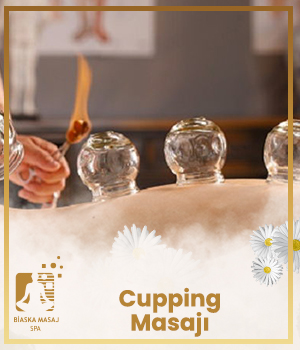 Cupping Masajı Çorlu